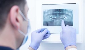 Advantages of Seeing An Oral Surgeon
