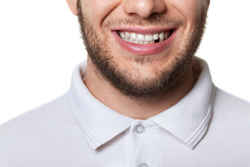 Dental Patient Missing A Tooth.