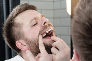 dental patient missing his first premolar